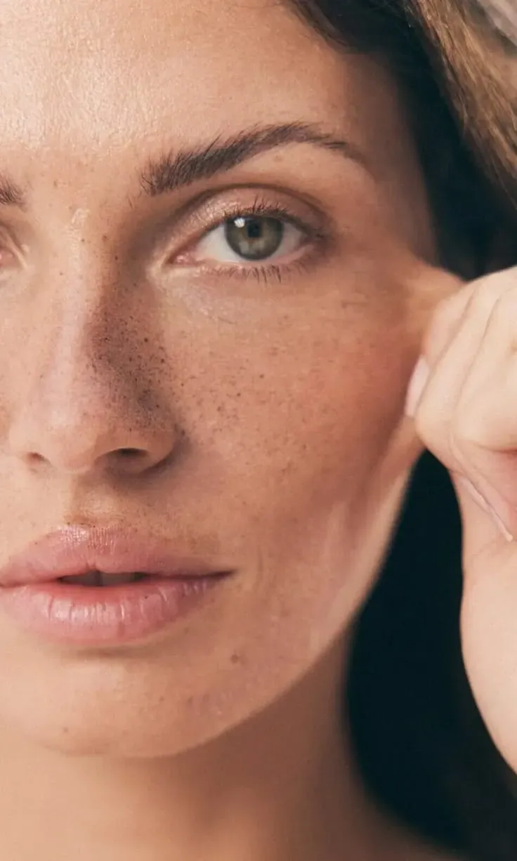 Cuidado Facial - Bioestimuladores de Colágeno em Joinville Mulher com sardas tocando o rosto, pele com textura natural, cuidado facial na Clínica Dra. Simoni Bett, Joinville