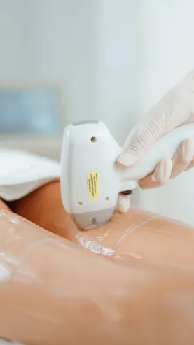 Depilação a Laser em Joinville: Como Funciona e Quantas Sessões Depilação a Laser em Joinville: Como Funciona e Quantas Sessões - Blog Clínica Dra. Simoni Bett