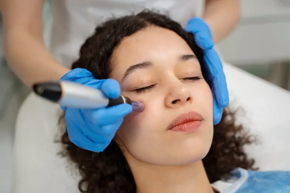 Microagulhamento Profissional em Joinville Aplicação de microagulhamento com dermapen na Clínica Dra. Simoni Bett, Joinville