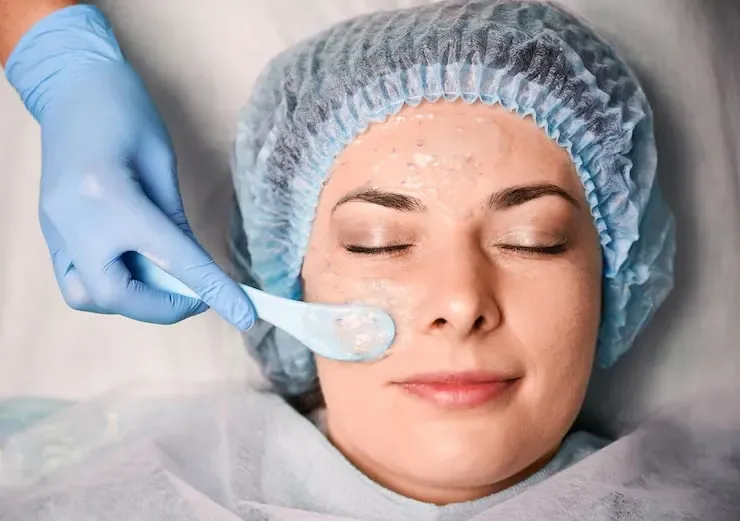 Tratamento facial para manchas na pele